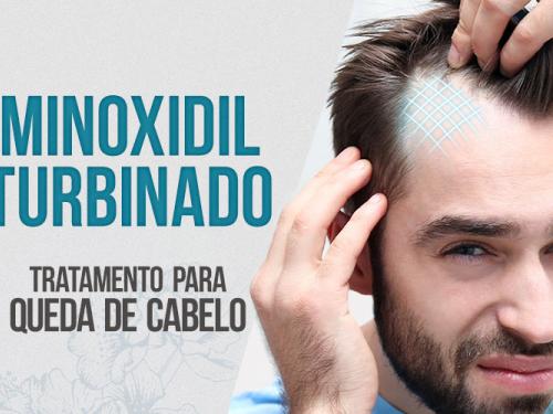 Minoxidil Turbinado: tratamento para queda de cabelo genética