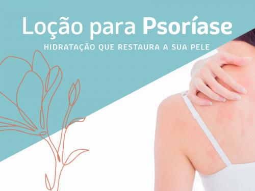 Loção para Psoríase ANDALIZ - com óleo de girassol